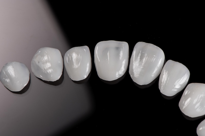 悅庭的雪曜瓷陶瓷貼片示意圖