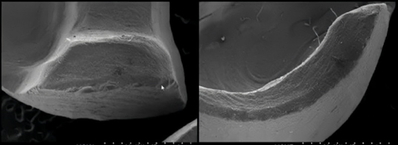 陶瓷貼片的電子顯微鏡截面影像，展示材料內部結構與邊緣細節